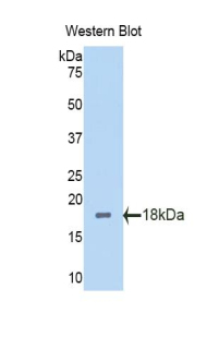 PBRM1 / BAF180 / PB1 Antibody - Western blot of PBRM1 / BAF180 / PB1 antibody.