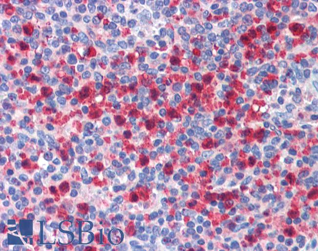 PBRM1 / BAF180 / PB1 Antibody - Anti-PBRM1 antibody IHC of human spleen. Immunohistochemistry of formalin-fixed, paraffin-embedded tissue after heat-induced antigen retrieval. Antibody concentration 5 ug/ml.  This image was taken for the unconjugated form of this product. Other forms have not been tested.