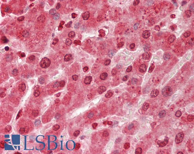 PBRM1 / BAF180 / PB1 Antibody - Human Liver: Formalin-Fixed, Paraffin-Embedded (FFPE).  This image was taken for the unconjugated form of this product. Other forms have not been tested.