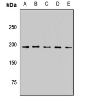PBRM1 / BAF180 / PB1 Antibody