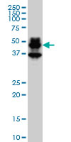 PBX1 Antibody - PBX1 monoclonal antibody (M01), clone 4A2 Western blot of PBX1 expression in HeLa NE.