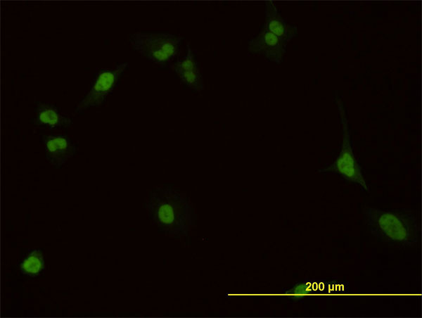 PBX1 Antibody - Immunofluorescence of monoclonal antibody to PBX1 on HeLa cell. [antibody concentration 10 ug/ml]
