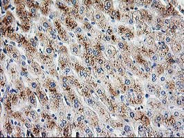 PBX1 Antibody - IHC of paraffin-embedded Human liver tissue using anti-PBX1 mouse monoclonal antibody.