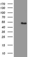 PBX1 Antibody - HEK293T cells were transfected with the pCMV6-ENTRY control (Left lane) or pCMV6-ENTRY PBX1 (Right lane) cDNA for 48 hrs and lysed. Equivalent amounts of cell lysates (5 ug per lane) were separated by SDS-PAGE and immunoblotted with anti-PBX1.