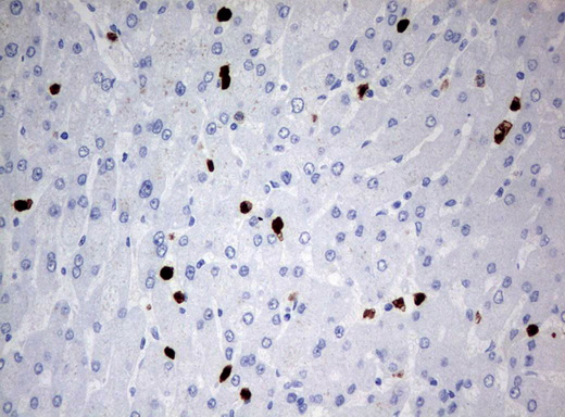 PBX1 Antibody - Immunohistochemical staining of paraffin-embedded Human liver tissue using anti-PBX1 mouse monoclonal antibody.  heat-induced epitope retrieval by 10mM citric buffer, pH6.0, 120C for 3min)