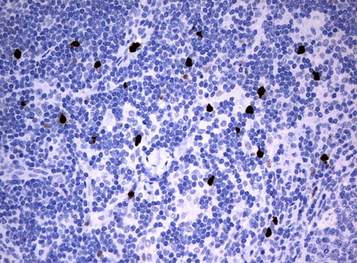 PBX1 Antibody - Immunohistochemical staining of paraffin-embedded Human lymph node tissue using anti-PBX1 mouse monoclonal antibody.  heat-induced epitope retrieval by 10mM citric buffer, pH6.0, 120C for 3min)