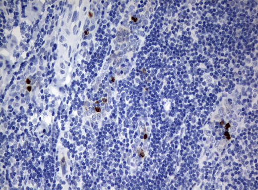 PBX1 Antibody - Immunohistochemical staining of paraffin-embedded Human tonsil using anti-PBX1 mouse monoclonal antibody.  heat-induced epitope retrieval by 10mM citric buffer, pH6.0, 120C for 3min)