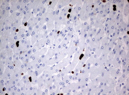 PBX1 Antibody - Immunohistochemical staining of paraffin-embedded Human liver tissue using anti-PBX1 mouse monoclonal antibody.  heat-induced epitope retrieval by 10mM citric buffer, pH6.0, 120C for 3min)