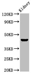 PBX1 Antibody - Positive Western Blot detected in Rat kidney tissue. All lanes: PBX1 antibody at 4.7 µg/ml Secondary Goat polyclonal to rabbit IgG at 1/50000 dilution. Predicted band size: 47, 39 KDa. Observed band size: 47 KDa