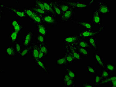 PBX1 Antibody - Immunofluorescence staining of Hela cells with PBX1 Antibody at 1:100, counter-stained with DAPI. The cells were fixed in 4% formaldehyde, permeabilized using 0.2% Triton X-100 and blocked in 10% normal Goat Serum. The cells were then incubated with the antibody overnight at 4°C. The secondary antibody was Alexa Fluor 488-congugated AffiniPure Goat Anti-Rabbit IgG(H+L).