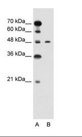PBX1 Antibody - A: Marker, B: Jurkat Cell Lysate.  This image was taken for the unconjugated form of this product. Other forms have not been tested.