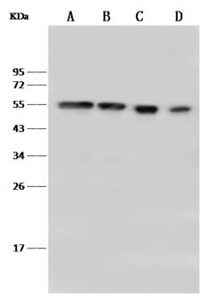 PBX1 Antibody - Anti-PBX1 rabbit polyclonal antibody at 1:500 dilution. Lane A: MOLT4 Whole Cell Lysate. Lane B: Jurkat Whole Cell Lysate. Lane C: HeLa Whole Cell Lysate. Lane D: K562 Whole Cell Lysate. Lysates/proteins at 30 ug per lane. Secondary: Goat Anti-Rabbit IgG (H+L)/HRP at 1/10000 dilution. Developed using the ECL technique. Performed under reducing conditions. Predicted band size: 47 kDa. Observed band size: 54 kDa.