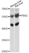 PBX2 Antibody - Western blot analysis of extracts of various cell lines, using PBX2 antibody at 1:1000 dilution. The secondary antibody used was an HRP Goat Anti-Rabbit IgG (H+L) at 1:10000 dilution. Lysates were loaded 25ug per lane and 3% nonfat dry milk in TBST was used for blocking. An ECL Kit was used for detection and the exposure time was 5s.