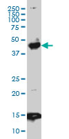 PBX3 Antibody - PBX3 monoclonal antibody (M01), clone 1A9 Western blot of PBX3 expression in HeLa NE.