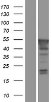 PBX4 Protein - Western validation with an anti-DDK antibody * L: Control HEK293 lysate R: Over-expression lysate