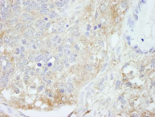 PBXIP1 / HPIP Antibody - Detection of Mouse HPIP by Immunohistochemistry. Sample: FFPE section of mouse teratoma. Antibody: Affinity purified rabbit anti-HPIP used at a dilution of 1:100.