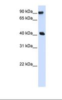 PBXIP1 / HPIP Antibody - Transfected 293T cell lysate. Antibody concentration: 1.0 ug/ml. Gel concentration: 12%.  This image was taken for the unconjugated form of this product. Other forms have not been tested.