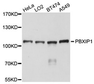 PBXIP1 / HPIP Antibody - Western blot analysis of extracts of various cells.