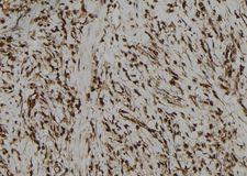 PBXIP1 / HPIP Antibody - 1:100 staining human gastric tissue by IHC-P. The sample was formaldehyde fixed and a heat mediated antigen retrieval step in citrate buffer was performed. The sample was then blocked and incubated with the antibody for 1.5 hours at 22°C. An HRP conjugated goat anti-rabbit antibody was used as the secondary.
