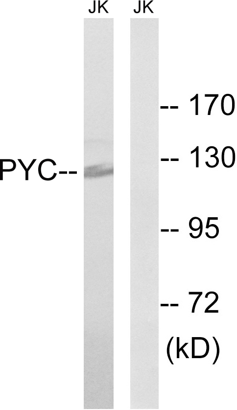 PC / Pyruvate Carboxylase Antibody - Western blot analysis of lysates from Jurkat cells, using PC Antibody. The lane on the right is blocked with the synthesized peptide.