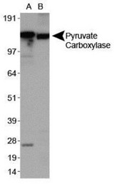 PC / Pyruvate Carboxylase Antibody - Western Blot: Pyruvate Carboxylase Antibody - Analysis of Pyruvate Carboxylase in A. Human liver extracts and B. Mouse liver extracts.  This image was taken for the unconjugated form of this product. Other forms have not been tested.