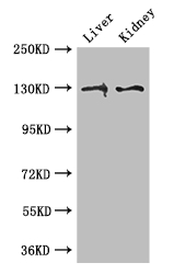 PC / Pyruvate Carboxylase Antibody - Positive WB detected in:Mouse liver tissue,Mouse kidney tissue;All lanes: PC antibody at 3ug/ml;Secondary;Goat polyclonal to rabbit IgG at 1/50000 dilution;Predicted band size: 130,58 kDa;Observed band size: 130 kDa;