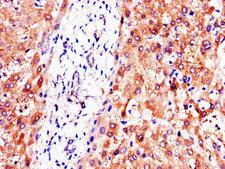 PC / Pyruvate Carboxylase Antibody - Immunohistochemistry of paraffin-embedded human liver tissue using PC Antibody at dilution of 1:100