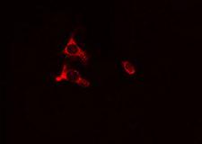 PC / Pyruvate Carboxylase Antibody - Staining HeLa cells by IF/ICC. The samples were fixed with PFA and permeabilized in 0.1% Triton X-100, then blocked in 10% serum for 45 min at 25°C. The primary antibody was diluted at 1:200 and incubated with the sample for 1 hour at 37°C. An Alexa Fluor 594 conjugated goat anti-rabbit IgG (H+L) antibody, diluted at 1/600, was used as secondary antibody.