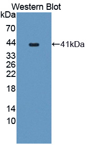 PC5 / PCSK5 Antibody - Western blot of PC5 / PCSK5 antibody.