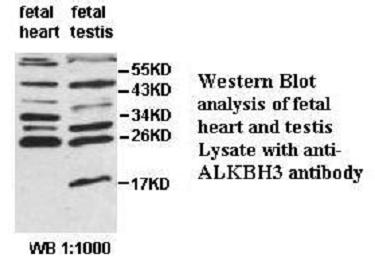 PCA1 / ALKBH3 Antibody