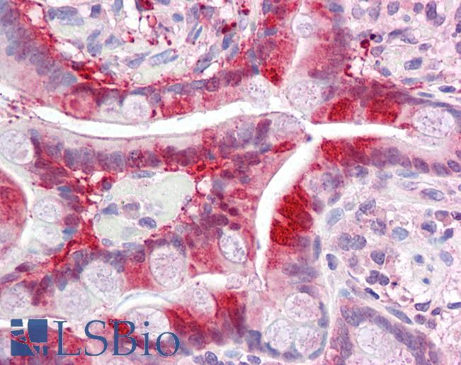 PCA1 / ALKBH3 Antibody - Anti-ALKBH3 antibody IHC of human small intestine. Immunohistochemistry of formalin-fixed, paraffin-embedded tissue after heat-induced antigen retrieval. Antibody concentration 5 ug/ml.  This image was taken for the unconjugated form of this product. Other forms have not been tested.