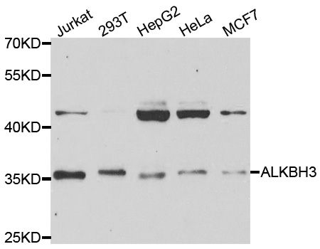 PCA1 / ALKBH3 Antibody - Western blot analysis of extracts of various cell lines.