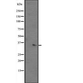 PCA1 / ALKBH3 Antibody - Western blot analysis of ALKBH3 expression in mouse kidney tissue lysates. The lane on the left is treated with the antigen-specific peptide.