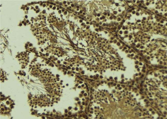 PCA1 / ALKBH3 Antibody - 1:100 staining mouse testis tissue by IHC-P. The sample was formaldehyde fixed and a heat mediated antigen retrieval step in citrate buffer was performed. The sample was then blocked and incubated with the antibody for 1.5 hours at 22°C. An HRP conjugated goat anti-rabbit antibody was used as the secondary.