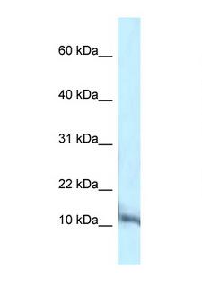 PCBD1 / PHS Antibody - PCBD1 / PCD antibody Western blot of Mouse Brain lysate. Antibody concentration 1 ug/ml.  This image was taken for the unconjugated form of this product. Other forms have not been tested.