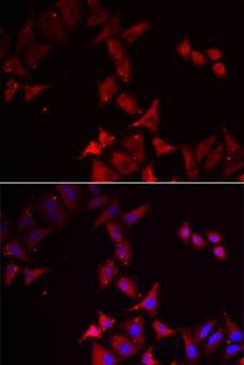 PCBD1 / PHS Antibody - Immunofluorescence analysis of U2OS cells.