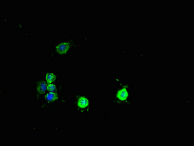 PCBD1 / PHS Antibody - Immunofluorescent analysis of Hela cells using PCBD1 Antibody at dilution of 1:100 and Alexa Fluor 488-congugated AffiniPure Goat Anti-Rabbit IgG(H+L)