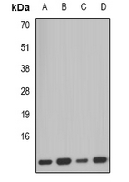PCBD1 / PHS Antibody - Western blot analysis of PCBD1 expression in SW620 (A); mouse kidney (B); mouse pancreas (C); rat liver (D) whole cell lysates.