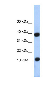 PCBD1 / PHS Antibody - PCBD1 / PCD antibody Western blot of Fetal Liver lysate. This image was taken for the unconjugated form of this product. Other forms have not been tested.