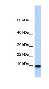 PCBD1 / PHS Antibody - PCBD1 / PCD antibody Western blot of Fetal Heart lysate. This image was taken for the unconjugated form of this product. Other forms have not been tested.
