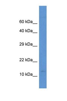PCBD2 Antibody - PCBD2 antibody Western blot of Small Intestine lysate. Antibody concentration 1 ug/ml.  This image was taken for the unconjugated form of this product. Other forms have not been tested.