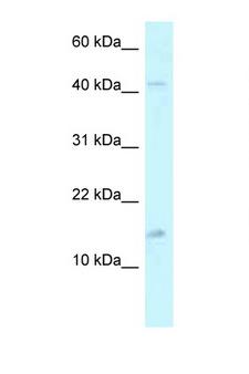 PCBD2 Antibody - PCBD2 antibody Western blot of 1 Cell lysate. Antibody concentration 1 ug/ml.  This image was taken for the unconjugated form of this product. Other forms have not been tested.