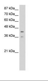 PCBP4 Antibody - Jurkat Cell Lysate.  This image was taken for the unconjugated form of this product. Other forms have not been tested.