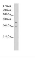 PCBP4 Antibody - Jurkat Cell Lysate.  This image was taken for the unconjugated form of this product. Other forms have not been tested.