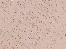 PCBP4 Antibody - Immunochemical staining of human PCBP4 in human brain with rabbit polyclonal antibody at 1:500 dilution, formalin-fixed paraffin embedded sections.