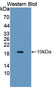 PCCA Antibody - Western Blot; Sample: Recombinant protein.