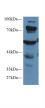 PCCA Antibody - Western Blot; Sample: Mouse Liver lysate; Primary Ab: 1µg/ml Rabbit Anti-Human PCCa Antibody Second Ab: 0.2µg/mL HRP-Linked Caprine Anti-Rabbit IgG Polyclonal Antibody