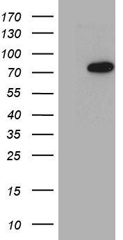 PCCA Antibody - HEK293T cells were transfected with the pCMV6-ENTRY control. (Left lane) or pCMV6-ENTRY PCCA. (Right lane) cDNA for 48 hrs and lysed. Equivalent amounts of cell lysates. (5 ug per lane) were separated by SDS-PAGE and immunoblotted with anti-PCCA. (1:2000)