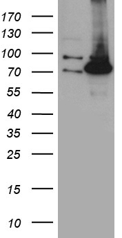 PCCA Antibody - HEK293T cells were transfected with the pCMV6-ENTRY control. (Left lane) or pCMV6-ENTRY PCCA. (Right lane) cDNA for 48 hrs and lysed. Equivalent amounts of cell lysates. (5 ug per lane) were separated by SDS-PAGE and immunoblotted with anti-PCCA. (1:2000)