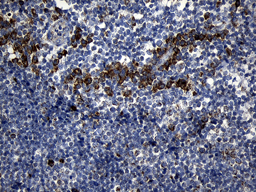 PCCA Antibody - Immunohistochemical staining of paraffin-embedded Human tonsil within the normal limits using anti-PCCA mouse monoclonal antibody. (Heat-induced epitope retrieval by 1mM EDTA in 10mM Tris buffer. (pH8.5) at 120°C for 3 min. (1:500)